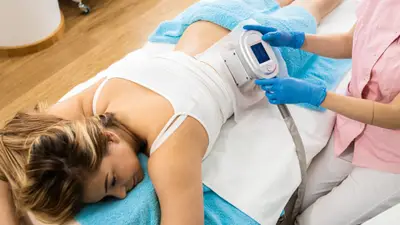Kriolipoliza w Body Evolution Jaworzno